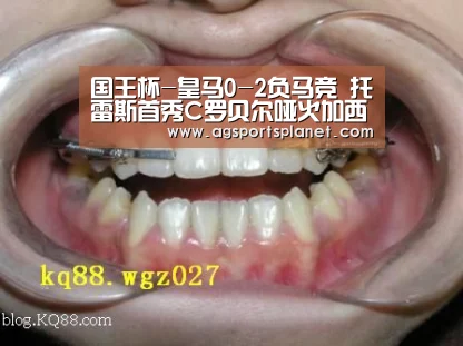 AG篮球